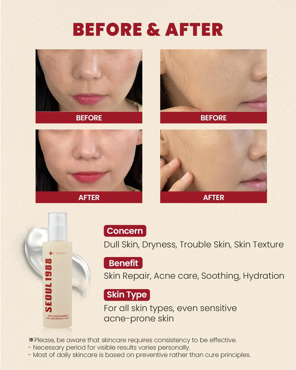 SEOUL 1988 Essence : Snail Mucin 97% + Rice